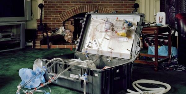 Yerine eksi 50 derecede gliserol enjekte ediliyor. Vcuda yaylm salanan solsyon vcut ssnn da eksi 50 dereceye dmesini salyor.