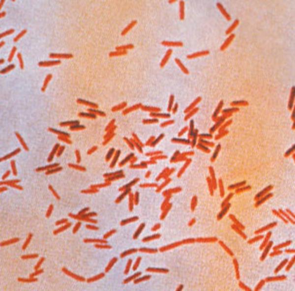 nsanda deri ve mukozalarda yaygn lser ve atele seyrediyor.