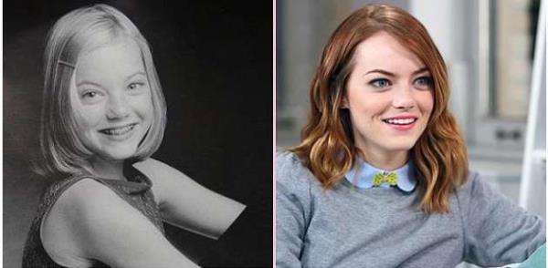 Emma Stone