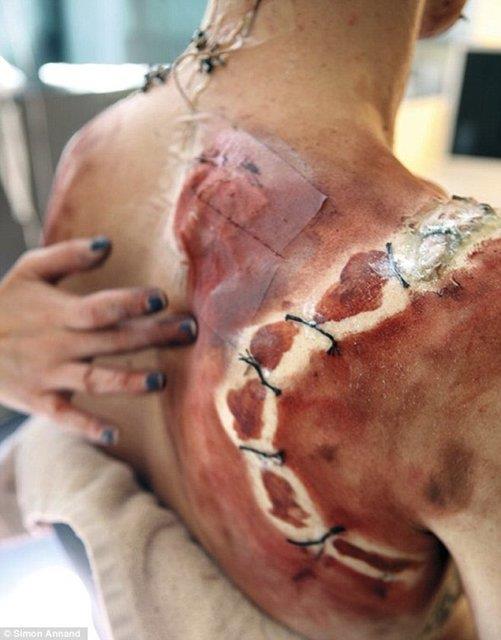 Yz kanla kaplanyor ve gsnden yzn boydan boya kaplayan ak yaraya siyah dikiler ekleniyor. Daha nce hibir yerde grlmemi ekimde Cumberbatch, canavara dnmenin bazen ok ac verici olduunu sylyor.