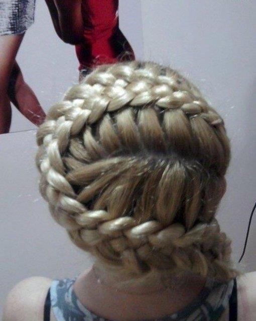 18-Ar ekillendirme: Yllar boyunca yaplan kuvvetli ekillendirme ve sa tedavileri san dklmesine neden olabilir. rnek olarak; sk sa rgleri, sa dzletirmek iin kullanlan kimyasal geveticiler verilebilir.