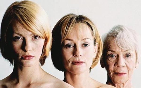 19-Yalanma: 50'li ve 60'l yalara giren kadnlarda sa dklmesi ve incelmesi sk grlmekle beraber nedeni henz bilinmemektedir.