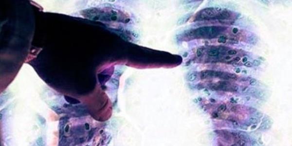 Beslenme programnz, kilonuz ve alkol kullanmnz, kanserin nksetme ihtimalini dorudan etkileyebilir.