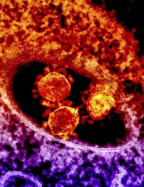 <br><b>1-MERS nedir? </b></br>  MERS yani Ortadou Solunum Yetmezlii Sendromu, viral bir solunum yolu hastal.