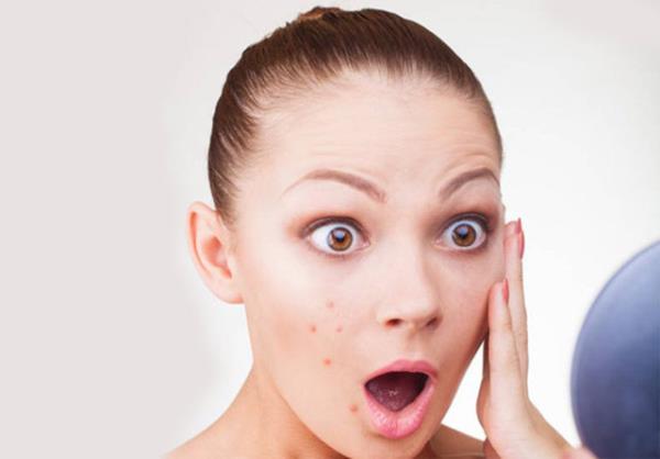 Aslnda sarms renkte bir salg olan sebum, sadece hava ile temas ettiinde rengi oksidasyona bal olarak koyulayor.