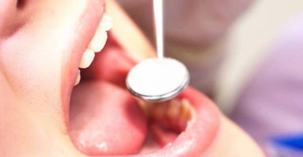 Dikkat edilmedii takdirde erken yalarda di kayplar grlmektedir.