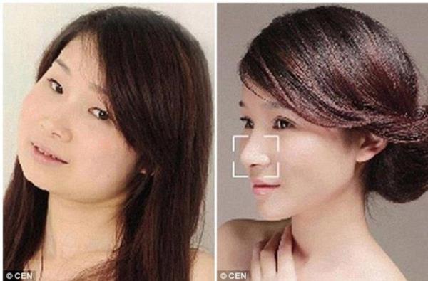 Anaokulu retmeni olan Xu Yan ene, burun ve botoks uygulamalar yaptrdktan sonra byle deiti.