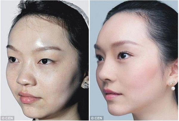 Lin Wen burun estetii, gz kapa ameliyat, botox ve kirpik estetii olmutur.