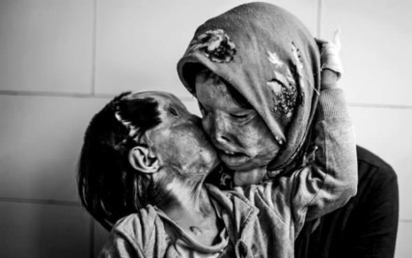 Asit saldrs maduru anne ve kz. Asiti zerlerine atan kii ise babas/kocas