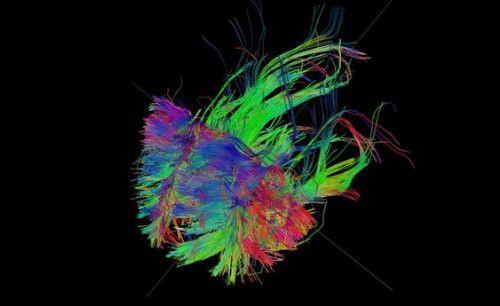 kinci olarak myelin klfyla evrili sinir hcreleri liflerinin bulunduu beyindeki beyaz blgeyi kaplayan anatomik ''devreler'' gzler nne serildi.