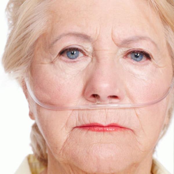 lmcl kanser trleri arasnda ilk srada yer alan akcier kanseri, kadnlar arasndaki kanser lmlerinin yzde 26'sndan sorumlu.