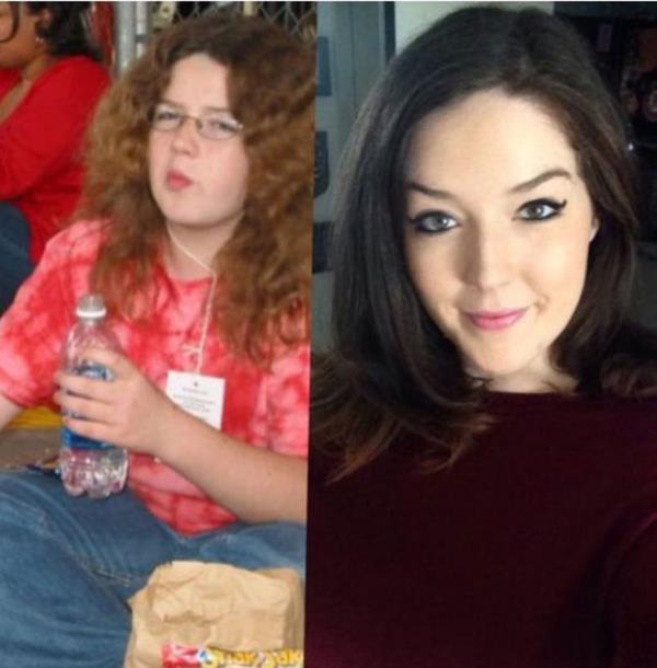 Kimisi ocukluklarnda yaad kilo sorunlar, cilt sorunlar veya estetik bozukluklaryla yaamlarn srdrmek zorunda kalyor.