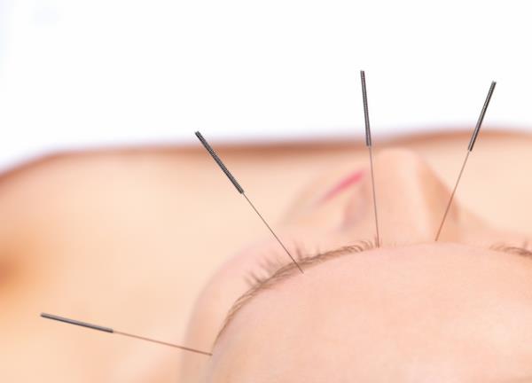 ''Akupunktur tedavisi orucu bozar m?'' ynndeki soru ise ''Akupunktur vcutta belirli noktalara ine batrarak eitli hastalklar tedavi etme metodudur. Orucu bozan eyler kapsamnda olmad yani vcudu beslemesi ve gdalandrmas sz konusu olmadndan akupunktur yaptrmak orucu bozmaz'' diye yantland.