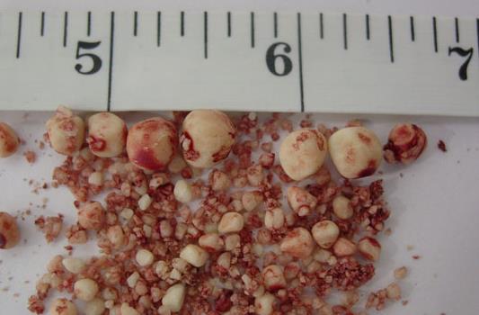 ''Bbrek ta krdrmak orucu bozar m?''  Orulu olan bir kimsenin vcuduna ifa veya gda verici bir madde enjekte edilmeden bbrek ta krdrmas ile orucun bozulmayaca ayrca operasyon esnasnda bbreklere kan akmasnn da orucu bozmayaca ifade edildi.