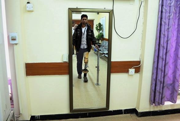 <p><b>12. Yapay organ ve uzuvlar</b></p>    Gelitirilen yapay organ ve uzuvlar ile bu organ ve uzuvlarn eksikliinden kaynaklanan hastalk ve sakatlklar tarihe karacak.