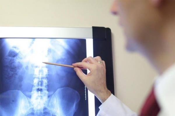 <p><b>Ka tane ftm var?</b></p>  Ftklar ou kez elmalar kadar kolay saylamayabilir. Ayn MR'a bakan farkl radyologlar farkl saylar syleyebilirler. Sonuta ok kk girinti ve kntlarn yorumlanmas sz konusudur. MR yumuak dokular ok iyi grntleyen bir yntem olarak baka birok hastalkla birlikte bel ft tehisinde de byk geliim salar. Ancak birok detay gsteren bu yntem bazen ihtiyacmzdan daha fazla bilgi ile bizi ba baa brakr. Aslnda nemli olan ka tane ftnz olduu deil, hangilerinin arnzn sebebi olduudur.