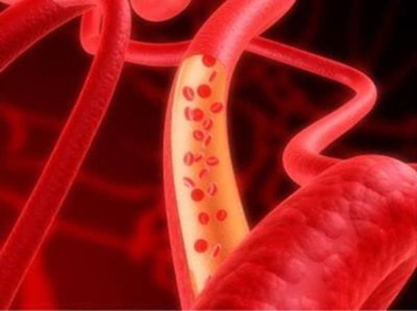 Kanmzdn krmz olmas krmz kan hcrelerini,yani alyuvarlar evreleyen ve aslnda demir ieren bir protein olan hemoglobin,oksijenle birleerek bilinen parlak kan rengini oluturur.