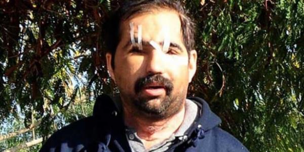 4 Temmuz ? Trkiye'nin 6. yz nakli Salih sln hayatn kaybetti