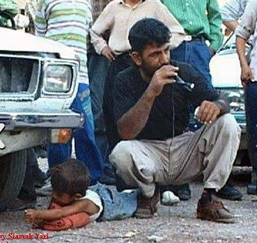 ran'da ekmek alarken yakalanan 8 yandaki ocuun kolu krld: SAHTE