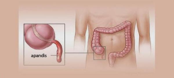 <br><b>Apandis </b></br>  Apandisin modern insanlarda bilinen hibir kullanm yoktur ve enfeksiyon kaptnda sk sk alnr.