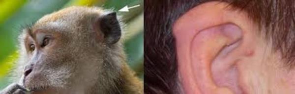 nsanlarn sadece %10.4'nde gemiimize ait bu kalnt grnr durumdadr fakat muhtemelen insanlarn ok daha fazlas bu kulak yumrusunu reten, ancak belirgin olmasn her zaman salamayan geni tamaktadr.