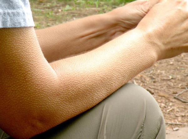 Korkma durumunda, hayvann daha iri grnmesini, dmann korkup kamasn salar.