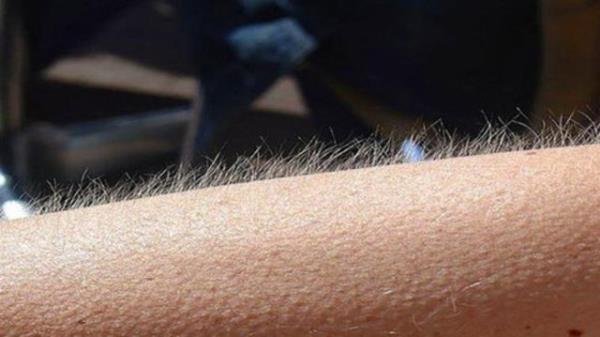 <br><b>Tylerin rpermesi Olay</b></br>   nsanlar dklerinde, korktuklarnda, kzdklarnda veya utandklarnda tyleri rperir. Birok canl trnn de ayn sebeplerle tyleri rperir.