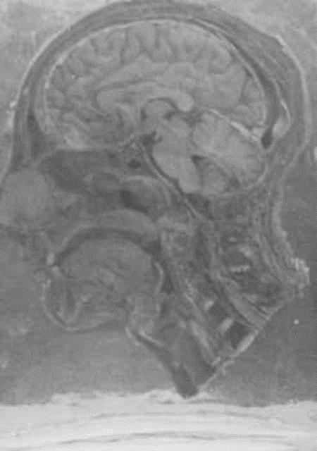 II. Dnya Sava srasnda, bir grup Alman doktor toplama kamplarndaki binlerce esir zerinde, onlarn rzasn almakszn ac veren ve genellikle lmle sonulanan deneyler yapt.