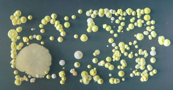 Surrey niversitesi Mikrobiyoloji blm rencileri cep telefonlarna yakndan bakmaya karar verince bakterileri farkettiler.