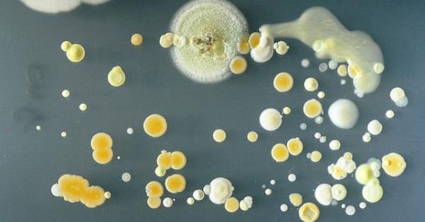 niversitede sren almalar srasnda bakteriler fotorafland ve bu grntler bytld. Bu bakterilerin tm, iren grnmelerine karn zararl deil.