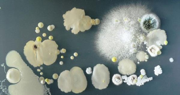 nanmas zor ama cep telefonlarnda tuvaletin 18 kat daha fazla bakteri bulundu. Cep telefonunu bakteri retme kaplarna koyan renciler, 3 gn sonra bu garip yaratklar grntlediler.