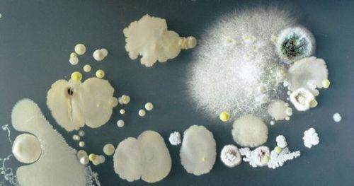 Surrey niversitesi Mikrobiyoloji blm rencileri cep telefonlarna yakndan bakmaya karar verince bakterileri farkettiler.  nanmas zor ama cep telefonlarnda tuvaletin 18 kat daha fazla bakteri bulundu. Cep telefonunu bakteri retme kaplarna koyan renciler, 3 gn sonra bu garip yaratklar grntlediler.