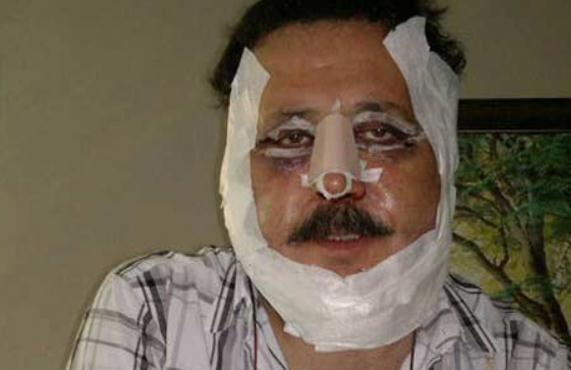 Gney ksa bir sre nce geirdii estetik operasyonla da basna haber olmutu.