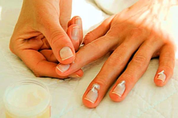 Gevek trnaklar<br>  Yerinden kan, gevek trnaklar hipertiroidizm belirtisi olabilir.