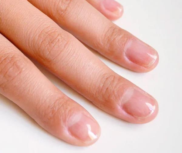 Zayf trnaklar<br>    Eer trnaklarnz abuk krlyor ve atlyorsa veya genel olarak zayfsa akrilik oje kullanmaya veya sk manikr yaptrmaya bir sre ara vermeniz sizin yararnza olacaktr.