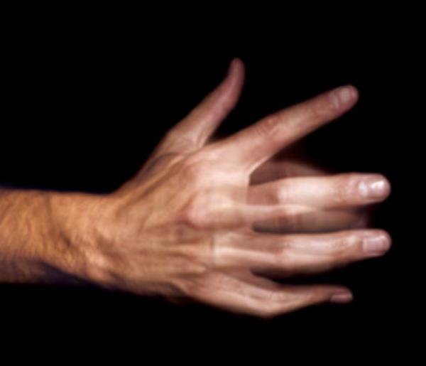 Vcudunda veya ellerinde istemsiz titreme var m?