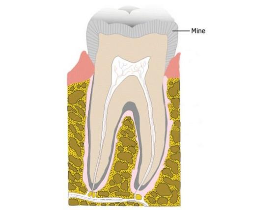 Di minesi insan vcudundaki en sert madde.
