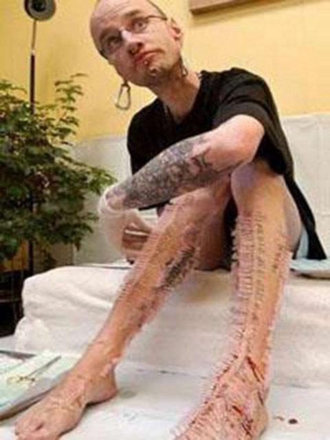 Kanadal bu gen adam ise Guinness Rekorlar Kitab'na girmek iin hi denenmemi bir yntem buldu. Bir buuk saat iinde vcuduna 1.000 tane ine batrarak kakts adam olma rekorunu krd.