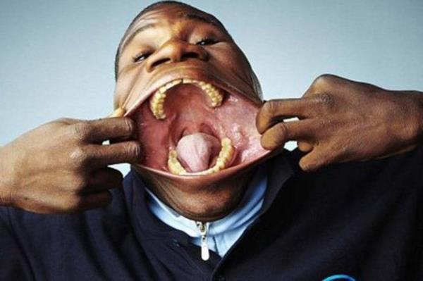 Angolal Francisco Domingo Joaquim dnyada &#8220;azn en geni aabilen adam&#8221; olarak Guinness Dnya Rekorlar Kitab'na girmeyi baard. Azn 17 cm geniliinde aabilen Joaquim, rekor srasndaki halini izleyenlere barolnde Jim Carrey&#8217;nin oynad &#8220;Maske&#8221; filmini hatrlatt.