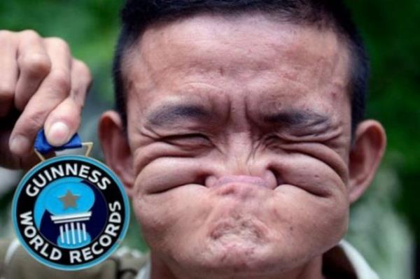 in&#8217;de yaayan Tang Shuquan &#8220;Dnyann en kvrak yz&#8221; unvann alarak Guinness Rekorlar Kitab&#8217;na girdi. Shuquan burnunu aznn iine alabiliyor. &#8220;Dnyann en kvrak yzl insan&#8221; olan Shuquan madalya ve 10 bin dolar para kazand. Dnyada kimsenin bu konuda onunla yaramayacan syleyen Shuquan geimini sokak gsterileri yaparak salyor.