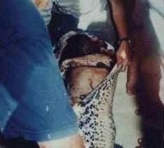 Ylann karnn yaran grevliler dehet verici manzarayla karlat. Zavall gen kadn ylan yutmutu.