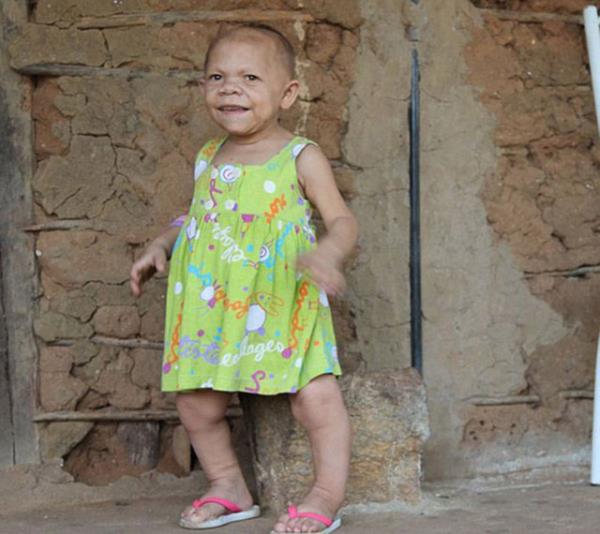 Bilim adamlar saylar bir elin parman gemeyen, hi bymeyen ocuklarn srrn zemedi.