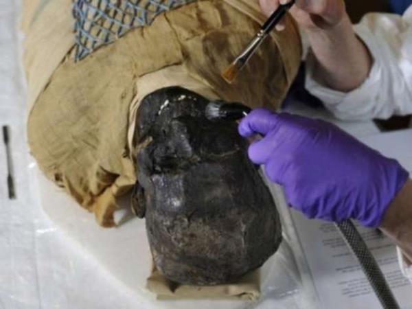 Bu kiinin cesedinin neden rmediini inceleyeceiz.