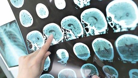 14- Yaplan beyin grntleme almasna gre, sevilen bir yemek dnldnde, dopamin ve mutluluk hormonu tetikleniyor. Bu hormonlar seks yaparken de tetikleniyor.