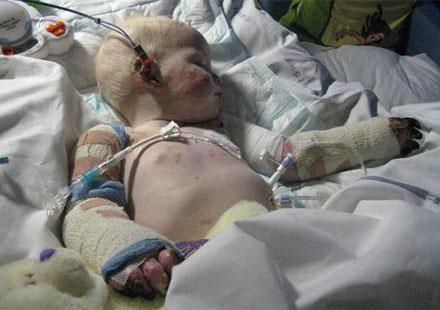 10) Menejit - Dnyada ylda 160 ile 300 bin kii bu  hastalk yznden (menenjit, Hepatit ve frengi) yaamn yitirmektedir.