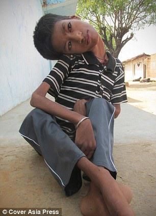 Brezilya'nn Monte Santo kentinde yaayan ve imdilerde 37 yanda olan Claudio Vieira de Oliveira doduunda, doktorlar ailesine onun iin hibir umut olmadn ve ocuklarn lme terk etmelerini sylemiti...