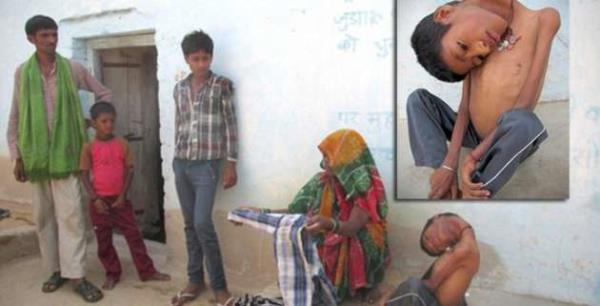 Ancak olduka nadir grlen bir eklem bozulmas nedeniyle boynu ters bir ekilde doan Oliveira...Doktorlarn bu szlerini boa karp muhasebeci ve kalabalklara ilham veren bir konumac oldu.