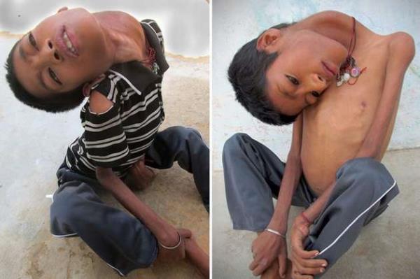 Anne Sumitra, "Eimle beraber ii olarak alyoruz. Hayatn btn zorluklarna kar direnebiliyoruz. Ama olumuzun bu hali bizi perien ediyor. Bu halini grmek ok ykc oluyor. Hibir ey yapamyor. Btn gn bir kede oturuyor, yaamyor gibi...