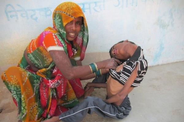Mahendra'y muayene eden Dr. Shashidhar Tatavarthy, ocukta ok nadir grlen bir kas bozukluu olduunu, daha net bir aklama iin genel bir salk taramasndan gemesi gerektiini syledi.