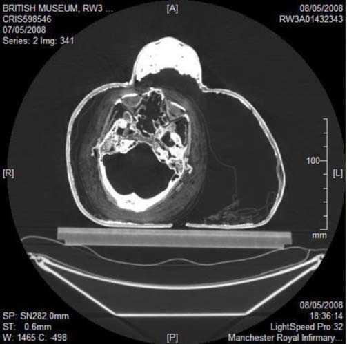 Dr. Helmi, British Museum'dan zel izinle ald yedi mumya zerinde bu cihaz test etti.